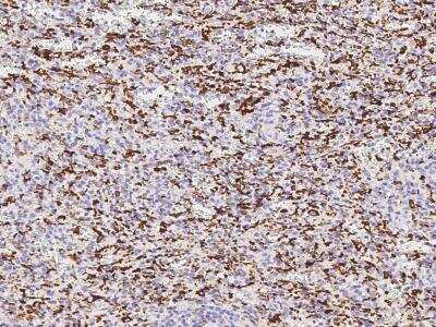 Immunohistochemistry-Paraffin: AIF-1/Iba1 Antibody (031) [NBP2-90271]