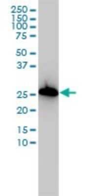 Western Blot: AIF-1/Iba1 Antibody (2A2-B6) [H00000199-M01]