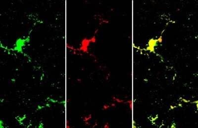 Immunohistochemistry-Frozen: AIF-1/Iba1 Antibody (HL22) [NBP3-13648]
