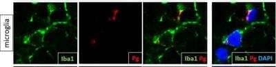 Immunocytochemistry/ Immunofluorescence: AIF-1/Iba1 Antibody [NB100-2833]