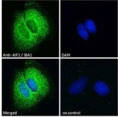 Immunocytochemistry/ Immunofluorescence: AIF-1/Iba1 Antibody [NBP1-06014]