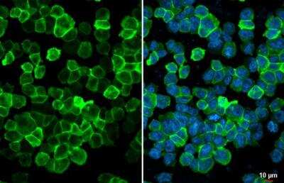 Immunocytochemistry/ Immunofluorescence: AIF-1/Iba1 Antibody [NBP2-16908]