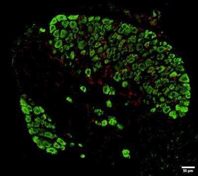 Immunocytochemistry/ Immunofluorescence: AIF-1/Iba1 Antibody [NBP2-19019]