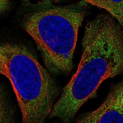 Immunocytochemistry/ Immunofluorescence: AIF-1/Iba1 Antibody [NBP2-68800]