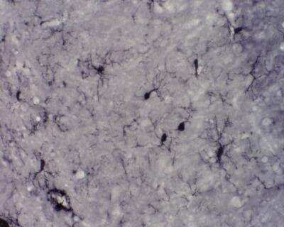 Immunohistochemical Staining of AIF-1/Iba1 in Frozen Rat Hippocampus
