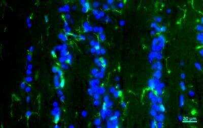 Immunohistochemical Detection of AIF-1/Iba1 in Frozen Feline Optic Nerve Microglia