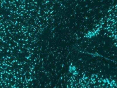 Immunohistochemical Detection of AIF-1/Iba1 in Paraffin Embedded Mouse Brain