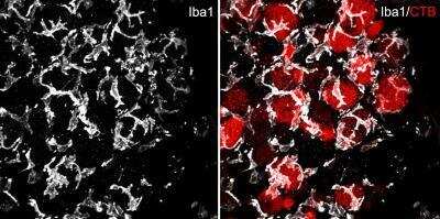 Immunohistochemical Detection of AIF-1/Iba1 in Mouse Dorsal Root Ganglia