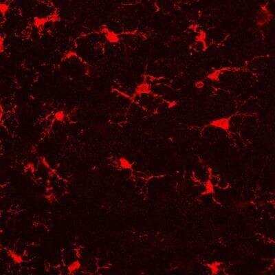 Immunohistochemical Staining of AIF-1/Iba1 in Mouse Brain