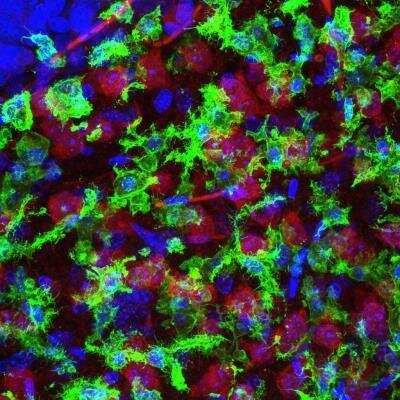 Immunohistochemical Staining of Mouse Brain Injected with Glioblastoma Cells