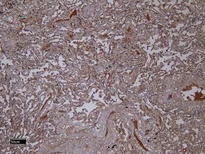 Immunohistochemistry-Paraffin: AIF-1/Iba1 Antibody [NB100-2833]