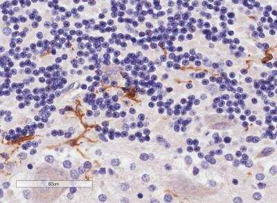 Immunohistochemistry-Paraffin: AIF-1/Iba1 Antibody [NBP1-06014]