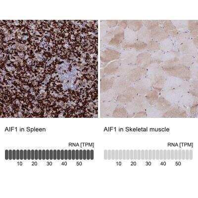 Immunohistochemistry-Paraffin: AIF-1/Iba1 Antibody [NBP2-14276]