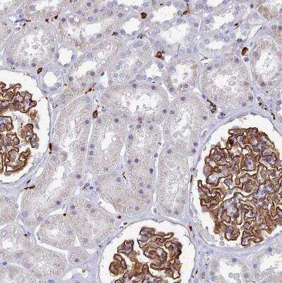 Immunohistochemistry-Paraffin: AIF-1/Iba1 Antibody [NBP2-14276]