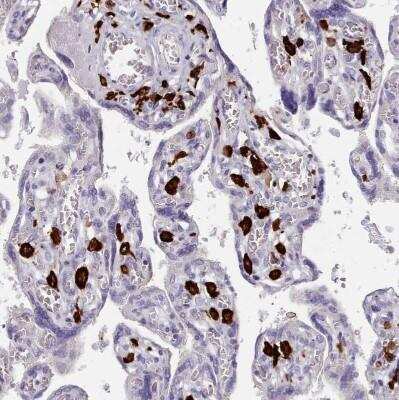 Immunohistochemistry-Paraffin: AIF-1/Iba1 Antibody [NBP2-14276]