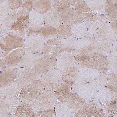 Immunohistochemistry-Paraffin: AIF-1/Iba1 Antibody [NBP2-14276]