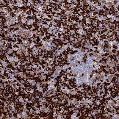 Immunohistochemistry-Paraffin: AIF-1/Iba1 Antibody [NBP2-14276]