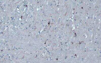 Immunohistochemistry-Paraffin: AIF-1/Iba1 Antibody [NBP2-16908]