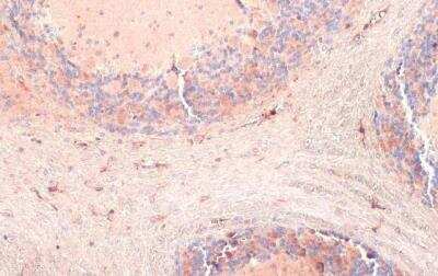 Immunohistochemistry-Paraffin: AIF-1/Iba1 Antibody [NBP2-16908]