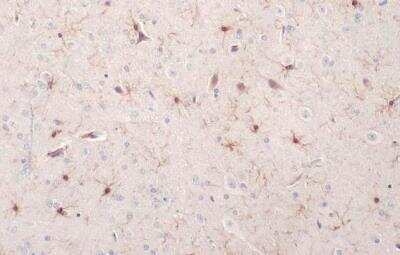 Immunohistochemistry-Paraffin: AIF-1/Iba1 Antibody [NBP2-16908]