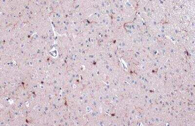 Immunohistochemistry-Paraffin: AIF-1/Iba1 Antibody [NBP2-19019]