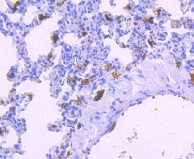 Immunohistochemistry-Paraffin: AIF-1/Iba1 Antibody (JM36-62) [NBP2-75397]