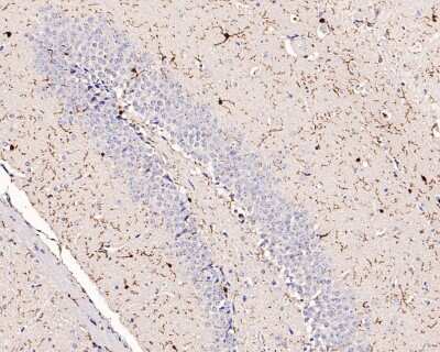 Immunohistochemistry-Paraffin: AIF-1/Iba1 Antibody (JM36-62) [NBP2-75397]