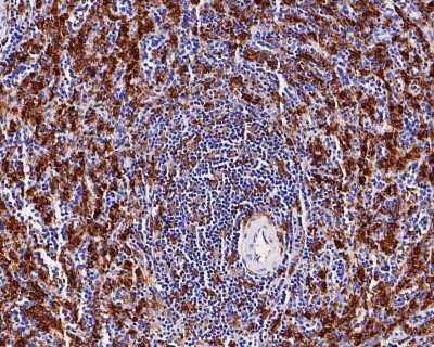 Immunohistochemistry-Paraffin: AIF-1/Iba1 Antibody (JM36-62) [NBP2-75397]