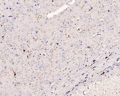 Immunohistochemistry-Paraffin: AIF-1/Iba1 Antibody (JM36-62) [NBP2-75397]