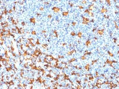 Immunohistochemistry-Paraffin: AIF-1/Iba1 Antibody (rAIF1/1909) [NBP2-75755]