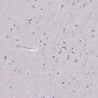Immunohistochemistry-Paraffin: AIF Antibody [NBP2-33932]