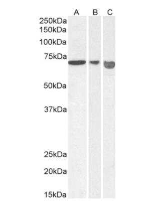 Western Blot: AIF Antibody [NBP2-42496]