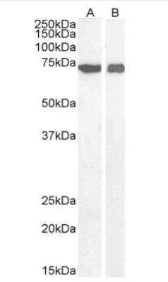 Western Blot: AIF Antibody [NBP2-42496]