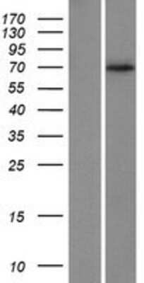 Western Blot: AIF Overexpression Lysate [NBP2-05373]