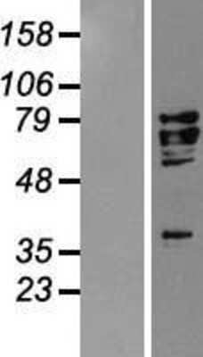 Western Blot: AIF Overexpression Lysate [NBP2-10578]