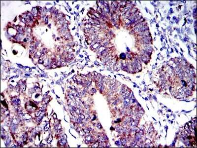 Immunohistochemistry-Paraffin: AIF Antibody (4E7) - BSA Free [NBP2-37577]