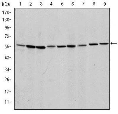 Western Blot: AIF Antibody (4E7)BSA Free [NBP2-37577]