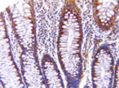 Immunohistochemistry-Paraffin: AIF Antibody [NBP2-27177]