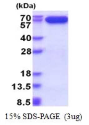 SDS-PAGE: Recombinant Human AIF His Protein [NBP2-51612]