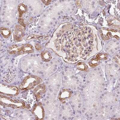 Immunohistochemistry: AIF1L Antibody [NBP2-38808]