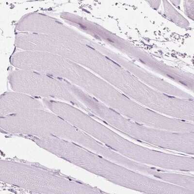 Immunohistochemistry-Paraffin: AIF1L Antibody [NBP2-32004]