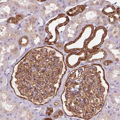 Immunohistochemistry-Paraffin: AIF1L Antibody [NBP2-32004]