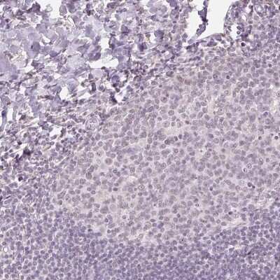 Immunohistochemistry-Paraffin: AIF1L Antibody [NBP2-38808]