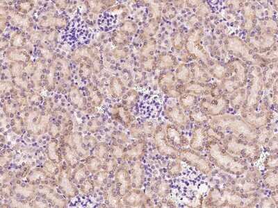 Immunohistochemistry-Paraffin: AIF1L Antibody [NBP2-99233]