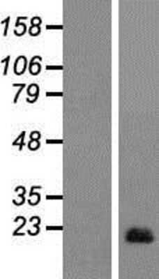 Western Blot: AIF1L Overexpression Lysate [NBP2-06130]