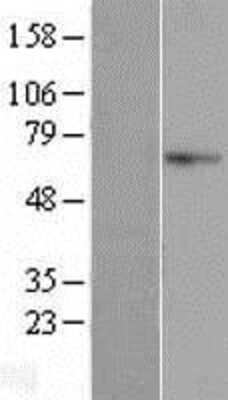 Western Blot: AIFM3 Overexpression Lysate [NBL1-07412]