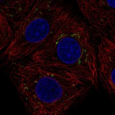 Immunocytochemistry/ Immunofluorescence: AIG1 Antibody [NBP2-38897]