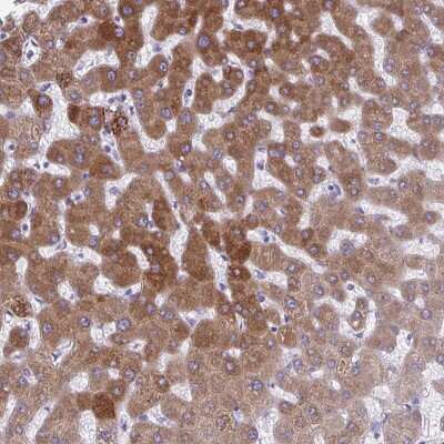 Immunohistochemistry: AIG1 Antibody [NBP2-38897]