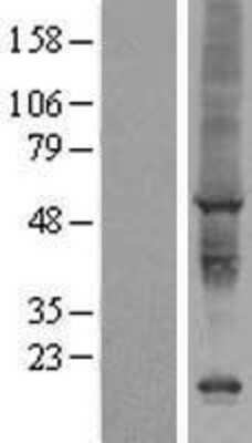 Western Blot: AIG1 Overexpression Lysate [NBP2-07090]