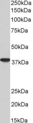 Western Blot: AIM2 Antibody (10M2B3)Azide and BSA Free [NBP2-80566]
